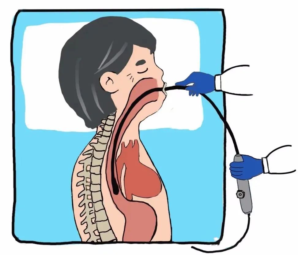 小探頭看大病 | 經(jīng)食道超聲立大功！